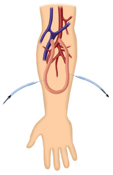 5912eaf85422e-Schermafbeelding_2017-05-1